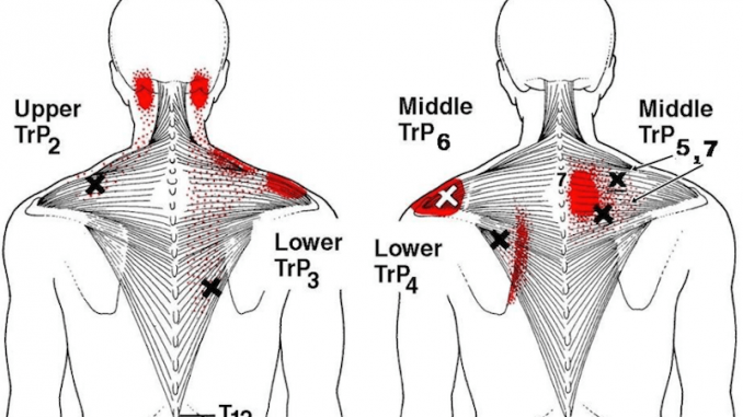 stiff-neck-tight-shoulder-stretches-678x381